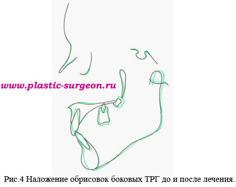 http://www.plastic-surgeon.ru/files/Statji/Desna/ris4.jpg